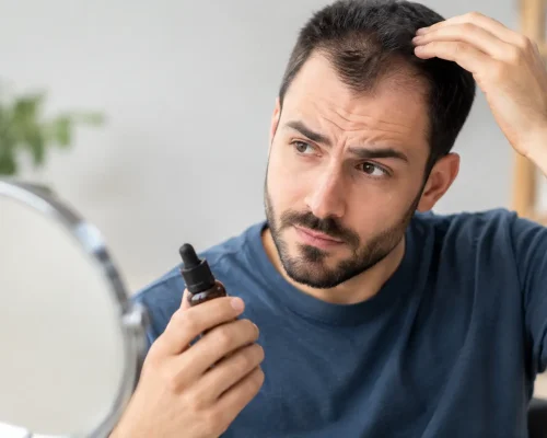 7 principais erros no uso do minoxidil