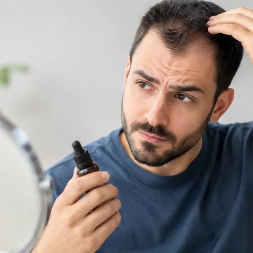 7 principais erros no uso do minoxidil