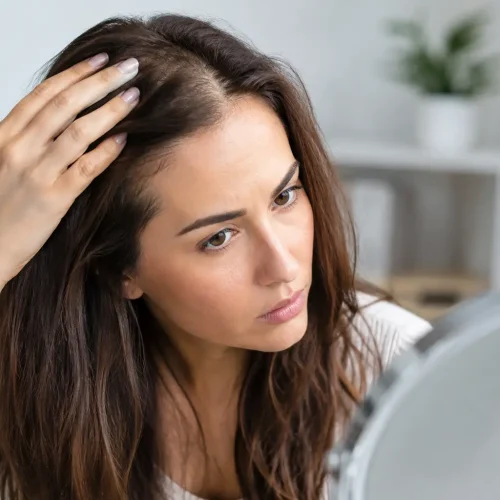 Calvície feminina: causas, sinais e tratamento